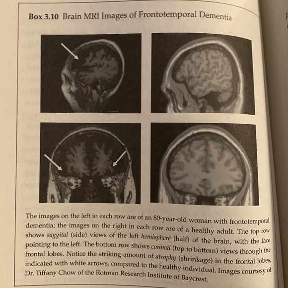 SALE!! Health. Living with mild cognitive impairment - Picture 12 of 12